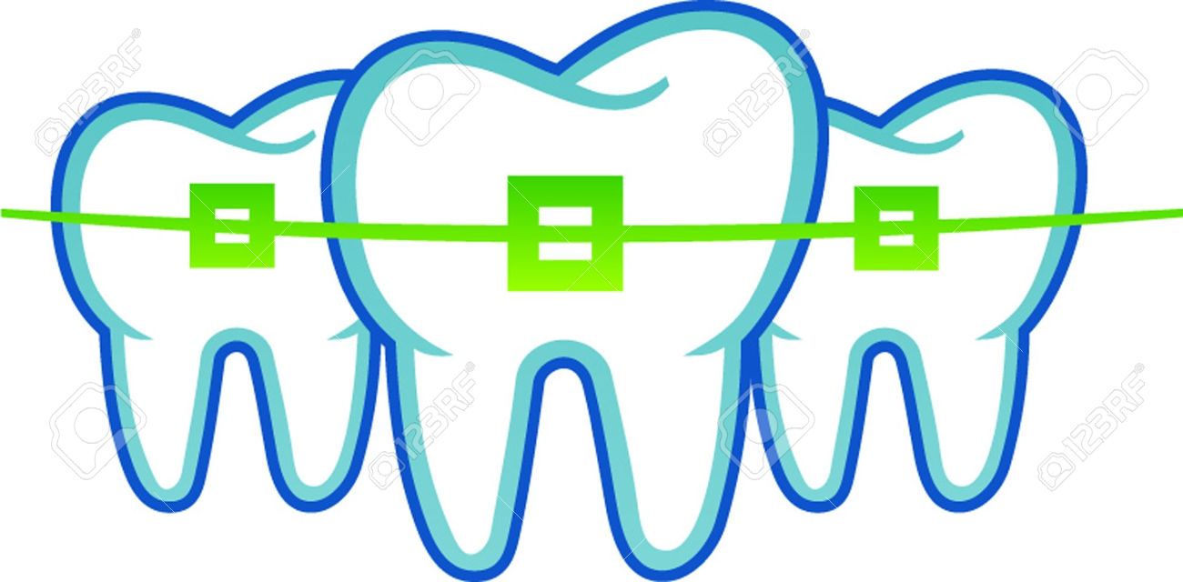 1300x640 Orthodontic Clipart