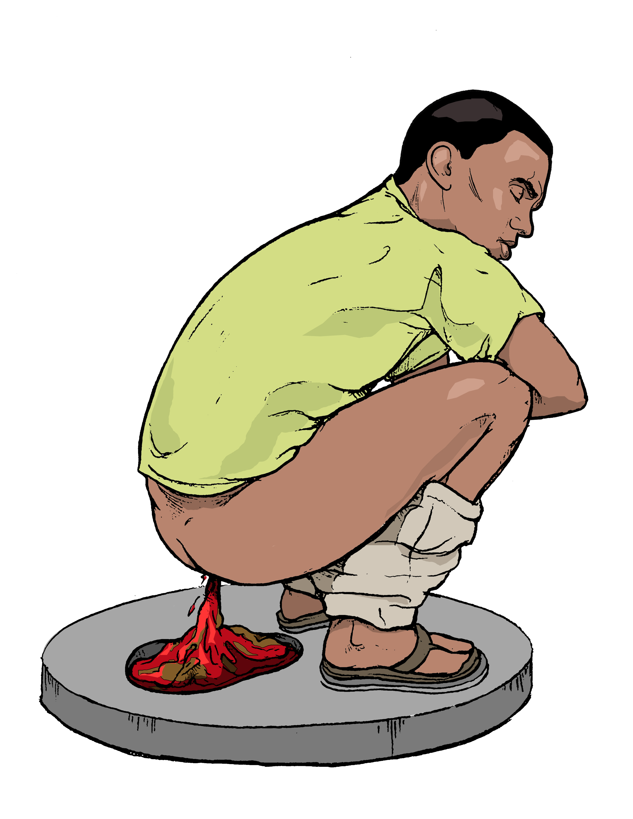 2550x3300 Causes Of Diarrhea Clip Art Cliparts