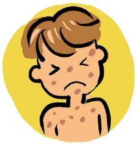 283x297 Corn Clip Art Skin Diseases Cliparts