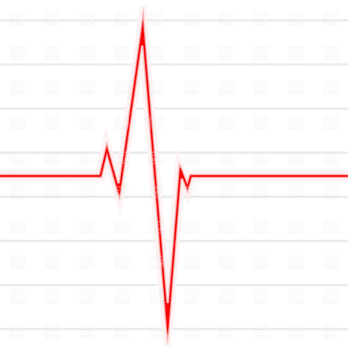 Ekg Cliparts Free Download On Clipartmag