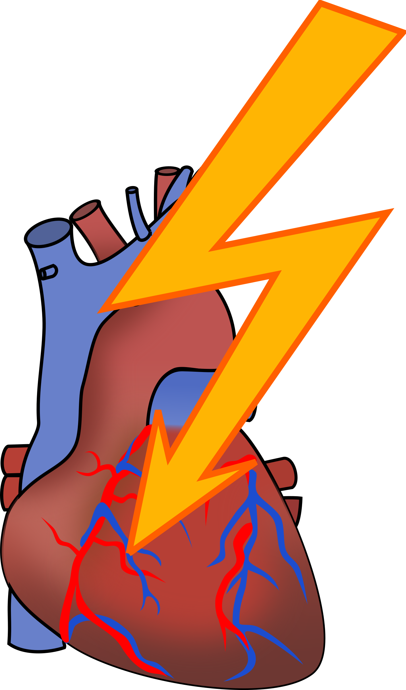 1414x2400 Broken Heart Clipart Heart Failure
