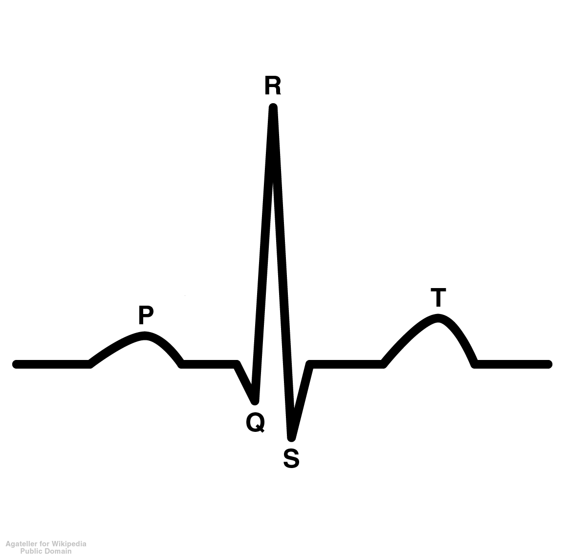 Flatline Ekg Cliparts Free Download On Clipartmag