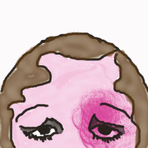 300x300 Migraines Picnic With Ants