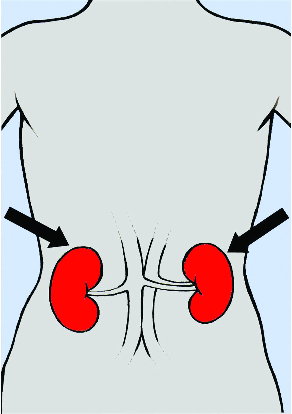 1240x1754 Leicestershire Diabetes Kidney Problems