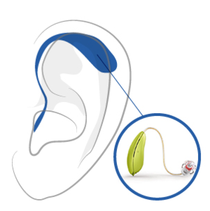298x300 Hearing Aid Technology