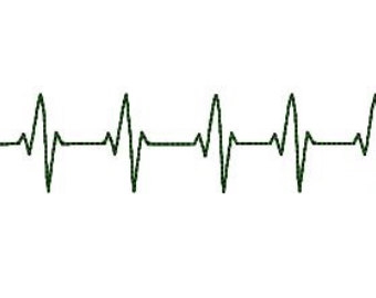 340x270 Line Clipart Heart Rhythm