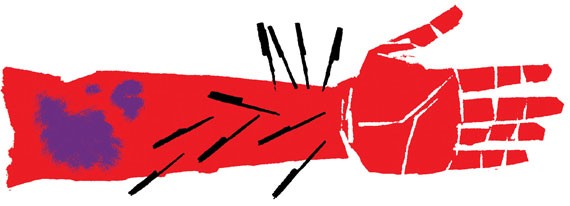 570x206 Pins And Needles