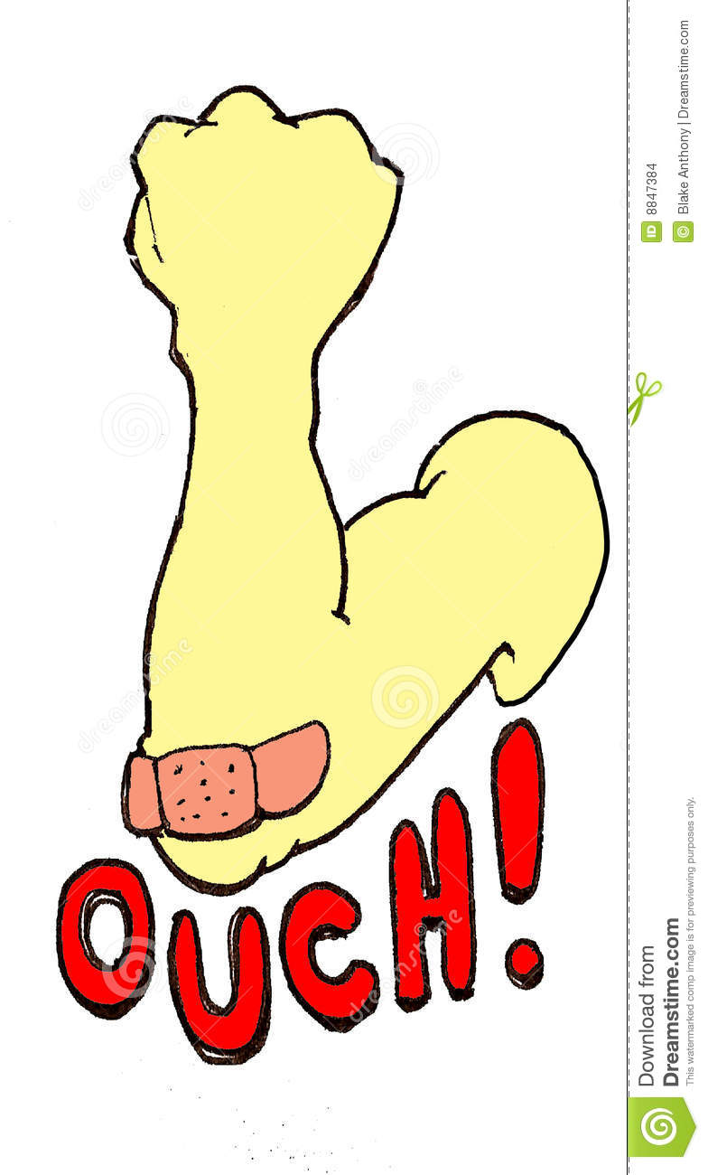 784x1300 Scratches Clipart Hurts