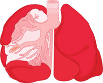 210x170 Search Results For Lungs