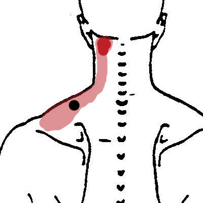 400x400 Massage Therapy Archives