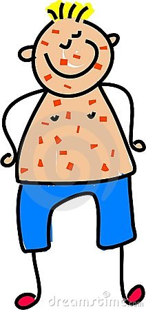 212x450 Measles Clipart
