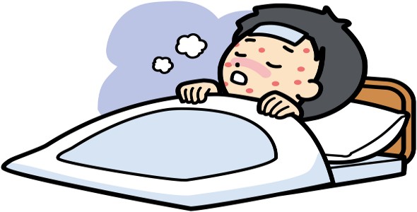 590x300 Skink Clipart Measles