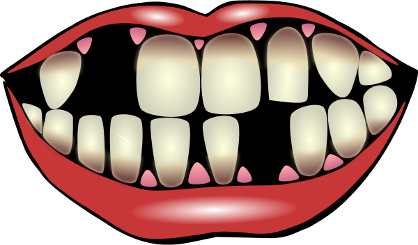 600x352 Mouth With Missing Teeth Clip Art