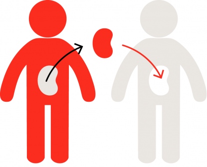 415x335 Organs Clipart Organ Donation