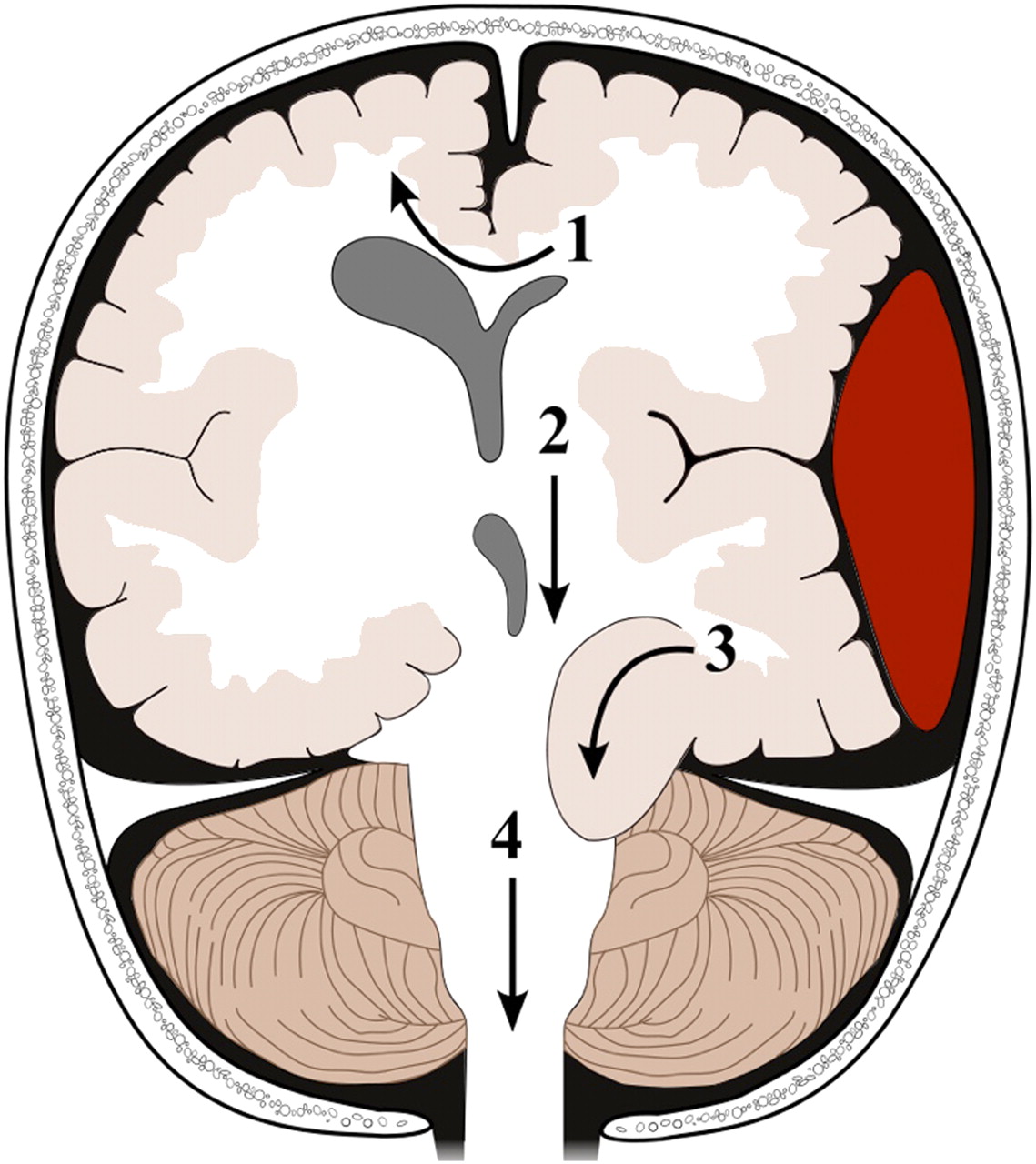 1139x1280 Pediatric Head Injury Articles Pediatrics In Review