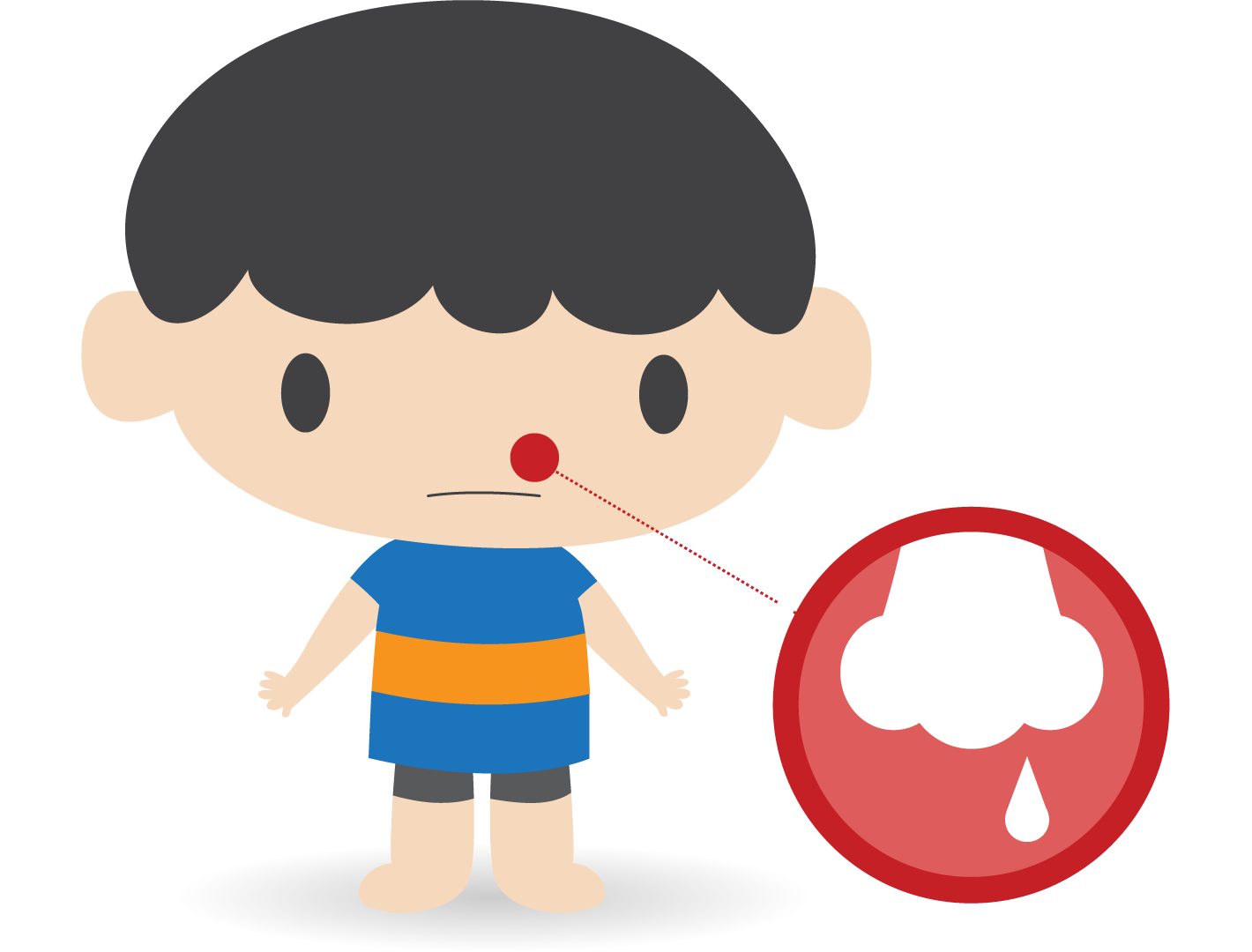 1420x1080 Nose Bleeds Alberta Health Services