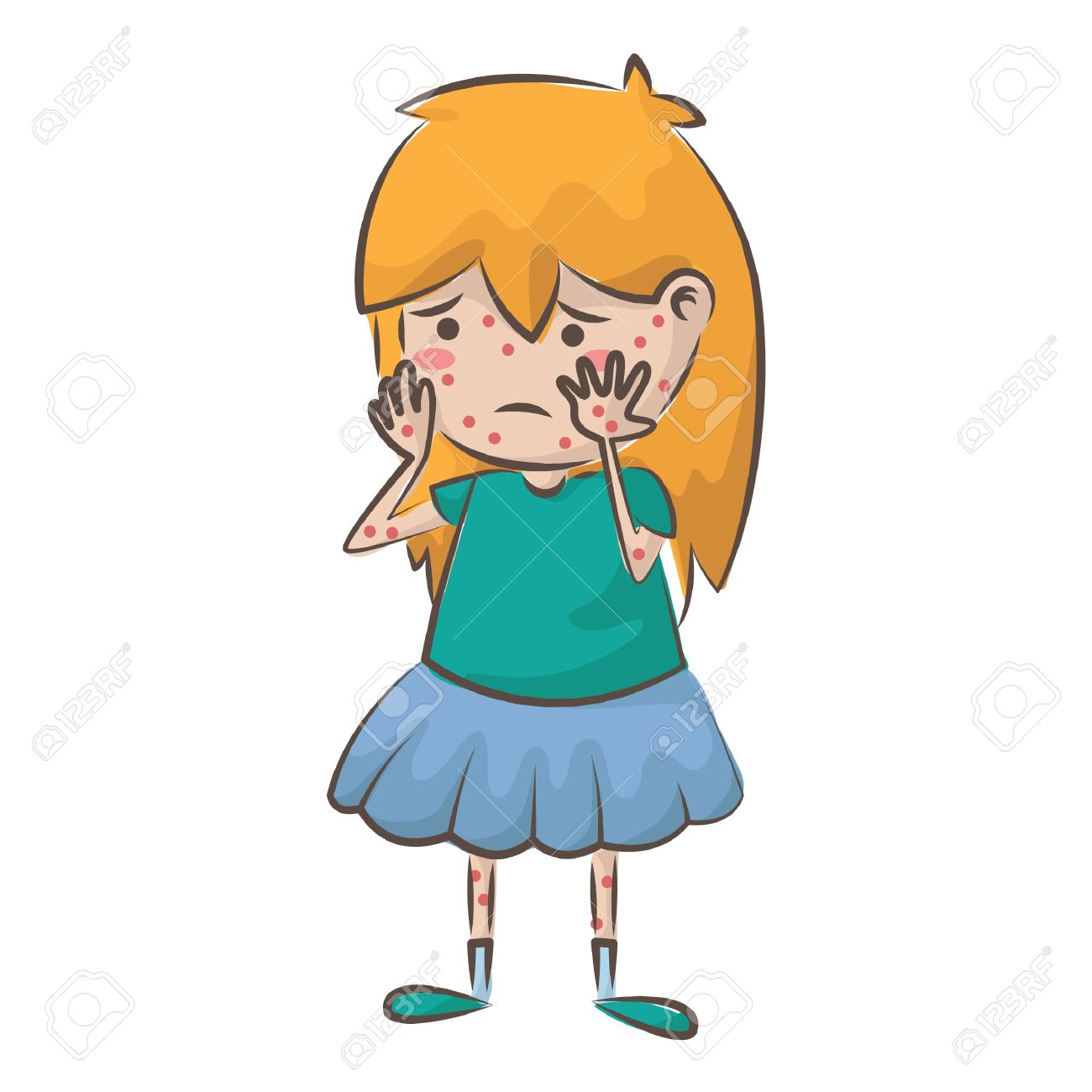 1300x1300 Girl With Chicken Pox Royalty Free Cliparts, Vectors, And Stock