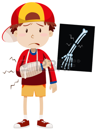 338x450 Boy With Broken Bone And X Ray Illustration Royalty Free Cliparts