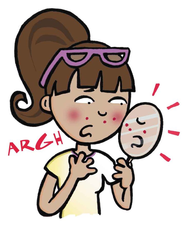 736x925 Mirror Clipart Acne