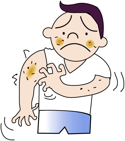 429x484 Allergies Symptoms Clip Art