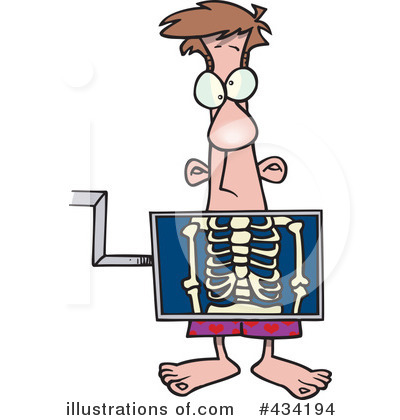 400x420 X Ray Clipart Radiology