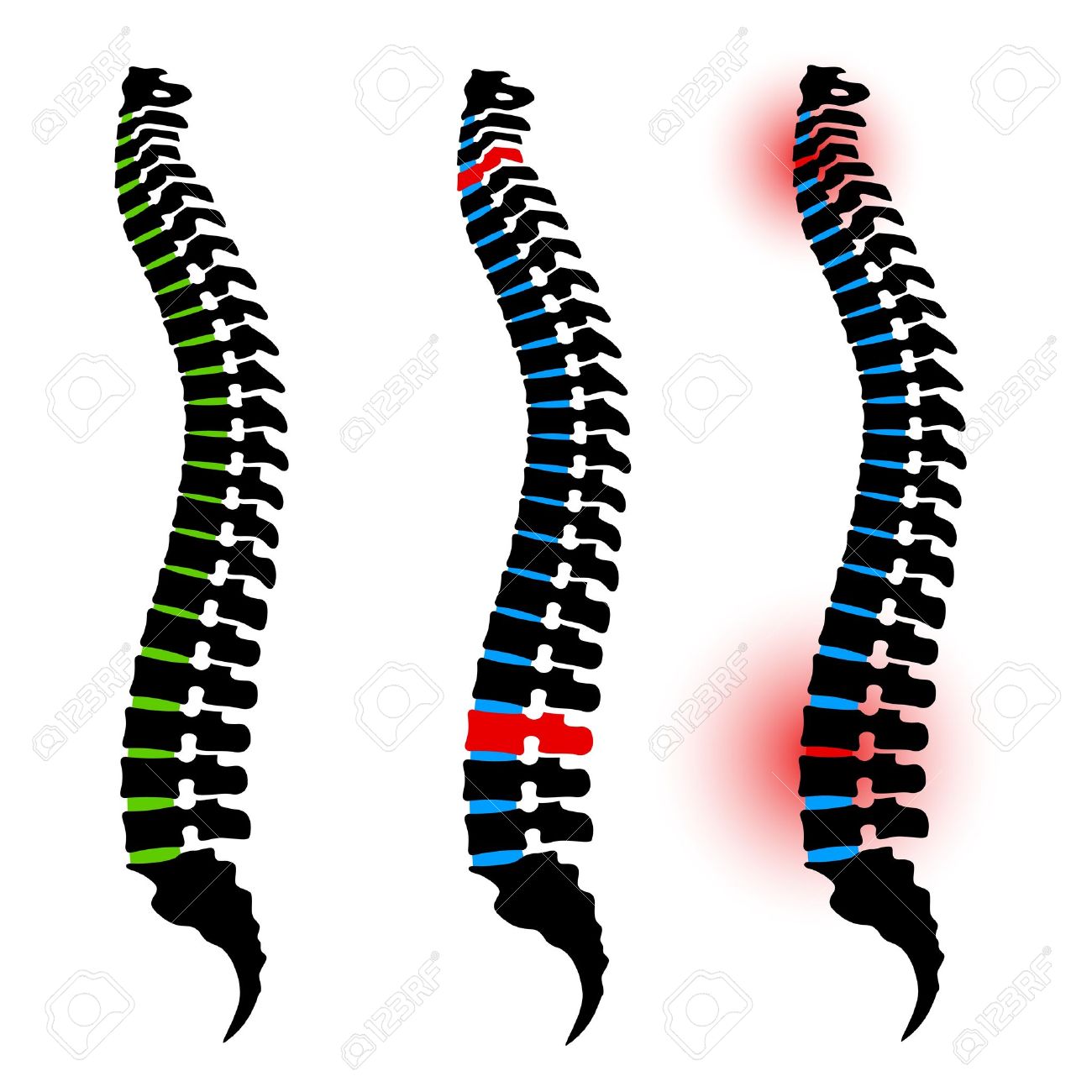 1300x1300 Spine Backbone Clip Art Cliparts