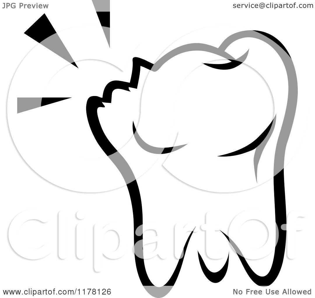 1080x1024 Broken Tooth Clip Art Cliparts