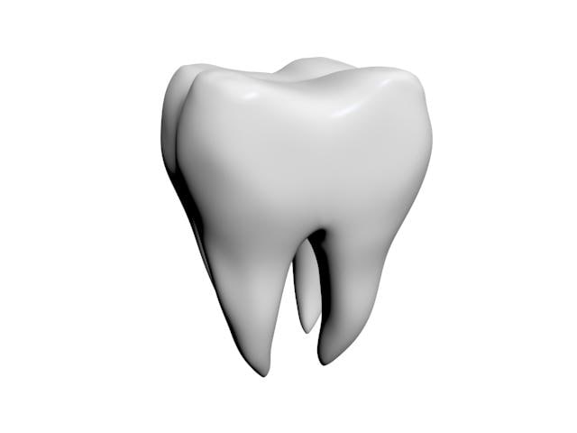 640x480 Tooth Roots 3d Model