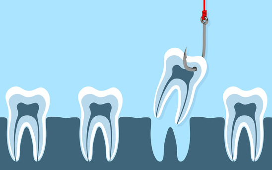 548x342 Tooth Extraction Common Reasons To Pull A Tooth