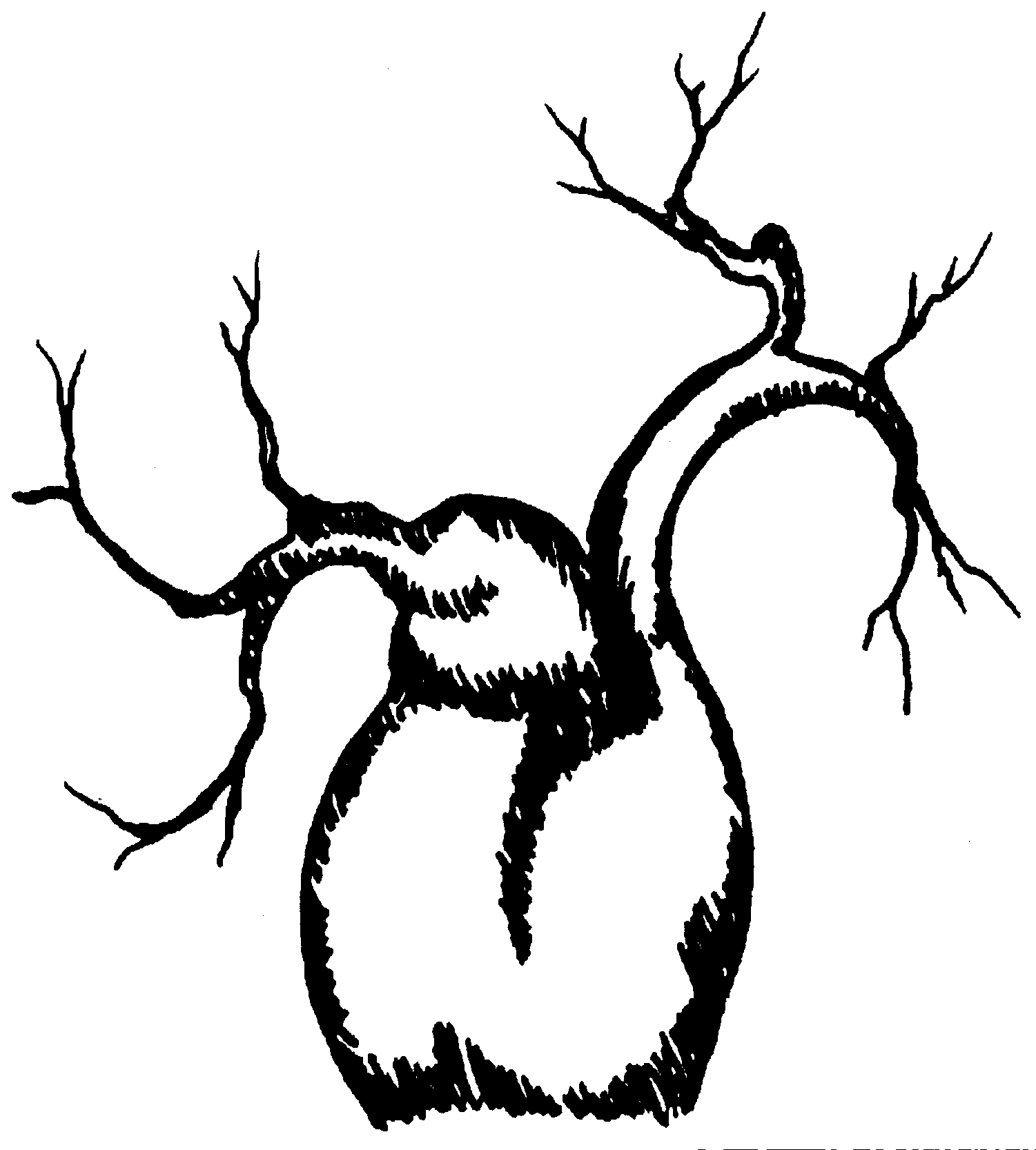 1501x1666 Tree Drawing Clip Art