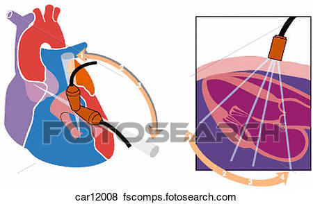 450x294 Stock Illustration Of Schematic Illustration Showing Ultrasound