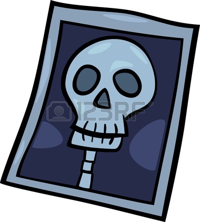405x450 Cartoon Illustration Of X Ray Photo Of Human Head Clip Art Royalty