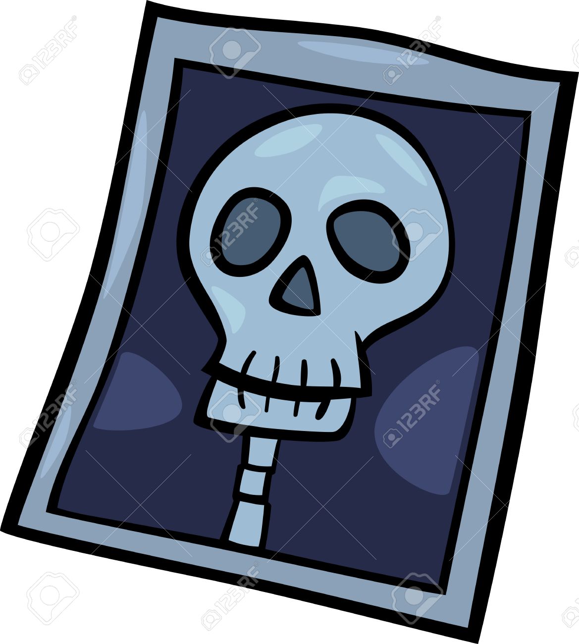1169x1300 Xray Skull Clipart, Explore Pictures