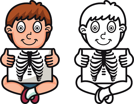 469x366 X Ray Clipart Boy